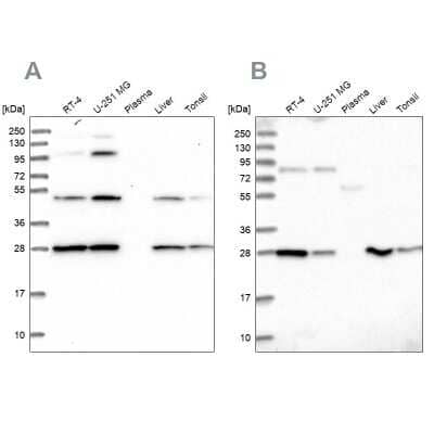 Western Blot: PGLS Antibody [NBP2-47333]