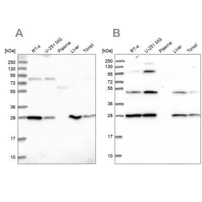 Western Blot: PGLS Antibody [NBP2-47334]