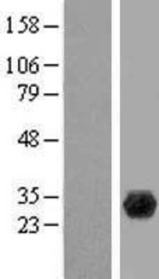 Western Blot: PGLS Overexpression Lysate [NBL1-14333]