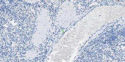 Immunohistochemistry-Paraffin: PGLYRP1/PGRP-S Antibody [NBP1-20962]