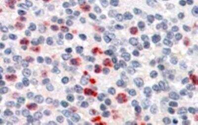 Immunohistochemistry-Paraffin: PGLYRP1/PGRP-S Antibody [NBP1-20962]