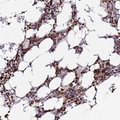 Immunohistochemistry-Paraffin: PGLYRP1/PGRP-S Antibody [NBP1-92261]