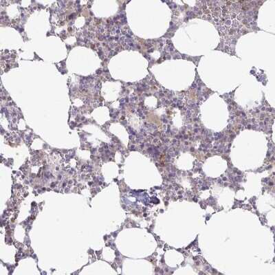 Immunohistochemistry-Paraffin: PGLYRP1/PGRP-S Antibody [NBP1-92261]