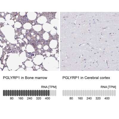 Immunohistochemistry-Paraffin: PGLYRP1/PGRP-S Antibody [NBP1-92261]