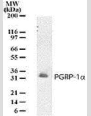 Western Blot: PGLYRP3/PGRPIA Antibody (187C434)Azide Free [NBP2-33249]