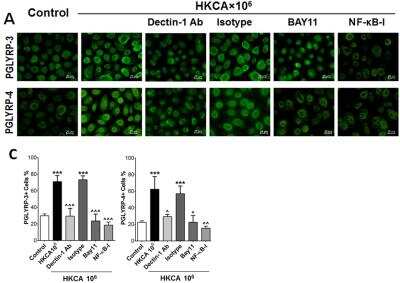 Immunocytochemistry/ Immunofluorescence: PGLYRP3/PGRPIA Antibody (187C434) [NB100-56729]