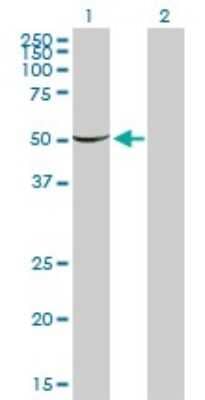 Western Blot: PGM1 Antibody (3B8-H4) [H00005236-M01]