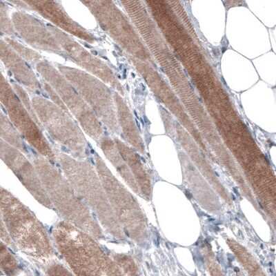 Immunohistochemistry: PGM1 Antibody (CL3299) [NBP2-61618]