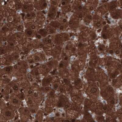 Immunohistochemistry: PGM1 Antibody (CL3299) [NBP2-61618]