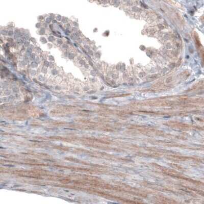 Immunohistochemistry: PGM1 Antibody (CL3299) [NBP2-61618]