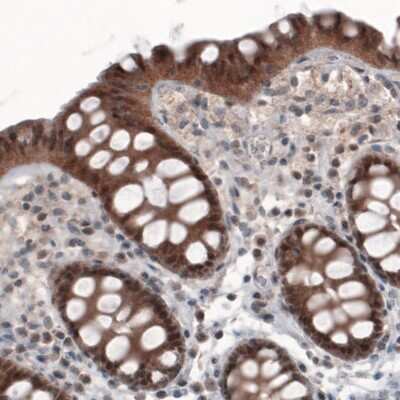 Immunohistochemistry: PGM1 Antibody (CL3299) [NBP2-61618]