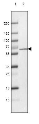 Western Blot: PGM1 Antibody (CL3299) [NBP2-61618]