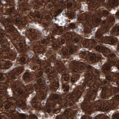 Immunohistochemistry-Paraffin: PGM1 Antibody (CL3301) [NBP2-59026]