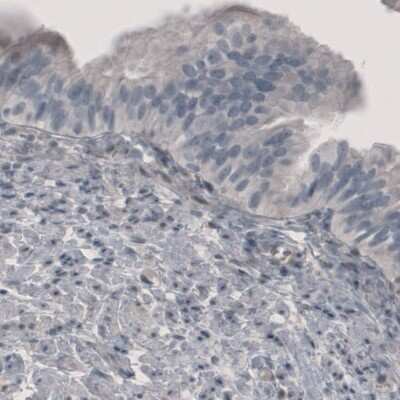 Immunohistochemistry-Paraffin: PGM1 Antibody (CL3301) [NBP2-59026]