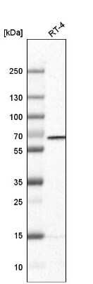 Western Blot: PGM1 Antibody (CL3301) [NBP2-59026]