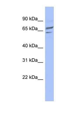 Western Blot: PGM1 Antibody [NBP1-56528]