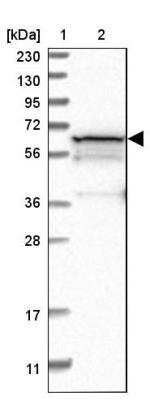 Western Blot: PGM1 Antibody [NBP1-85977]