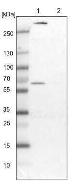 Western Blot: PGM1 Antibody [NBP1-85982]