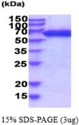 SDS-PAGE: Recombinant Human PGM1 His Protein [NBP2-52160]