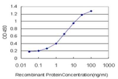 ELISA: PGM2 Antibody (1A3) [H00055276-M05]