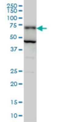 Western Blot: PGM2 Antibody (1A3) [H00055276-M05]