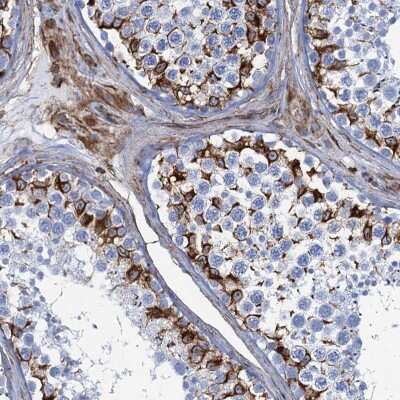 Immunohistochemistry: PGM2 Antibody [NBP2-32601]