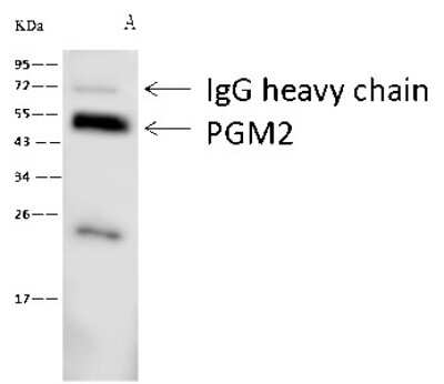 Immunoprecipitation: PGM2 Antibody [NBP2-99596]