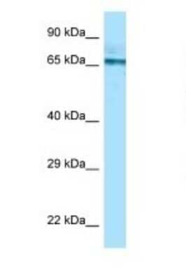 Western Blot: PGM2 Antibody [NBP1-98407]