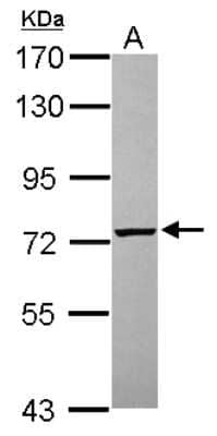 Western Blot: PGM2 Antibody [NBP2-19786]