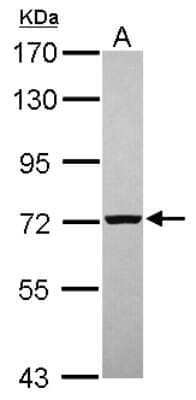 Western Blot: PGM2 Antibody [NBP2-19787]