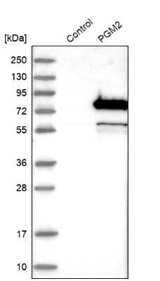 Western Blot: PGM2 Antibody [NBP2-32601]