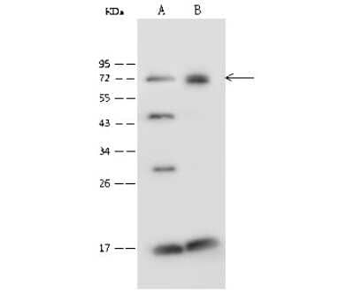 Western Blot: PGM2 Antibody [NBP2-99596]