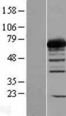 Western Blot: PGM2 Overexpression Lysate [NBL1-14338]