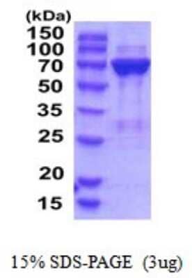 SDS-PAGE: Recombinant Human PGM2 His Protein [NBP2-52138]