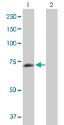 Western Blot: PGM2L1 Antibody [H00283209-B01P]