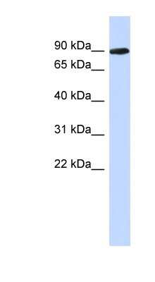 Western Blot: PGM2L1 Antibody [NBP1-56592]