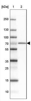 Western Blot: PGM2L1 Antibody [NBP2-31656]