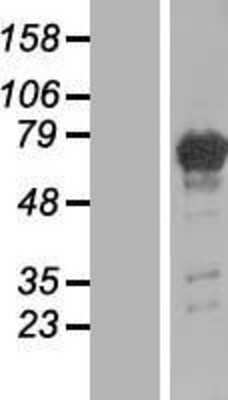 Western Blot: PGM2L1 Overexpression Lysate [NBL1-14339]