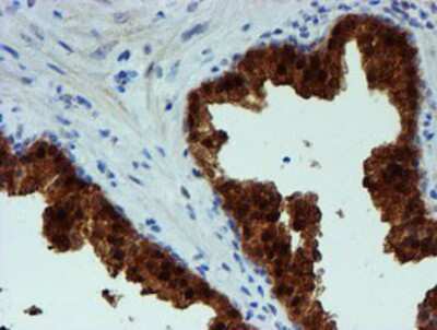 Immunohistochemistry-Paraffin: PGM3 Antibody (OTI1A11) [NBP2-03734]