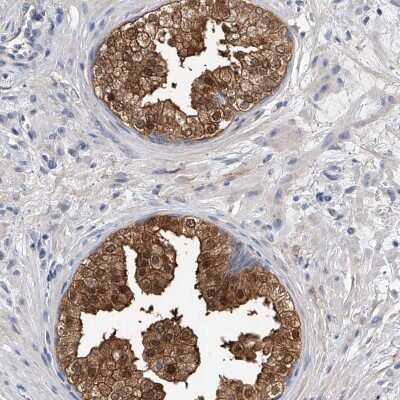 Immunohistochemistry-Paraffin: PGM3 Antibody [NBP1-89208]
