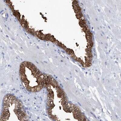 Immunohistochemistry-Paraffin: PGM3 Antibody [NBP1-89209]
