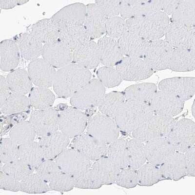 Immunohistochemistry-Paraffin: PGM3 Antibody [NBP1-89209]