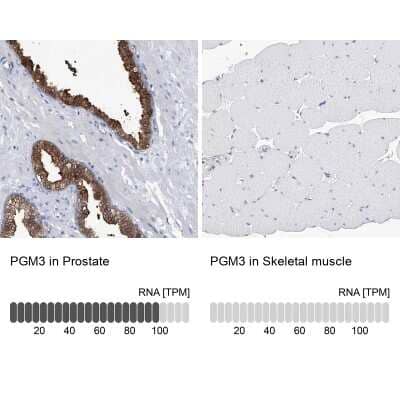 Immunohistochemistry-Paraffin: PGM3 Antibody [NBP1-89209]