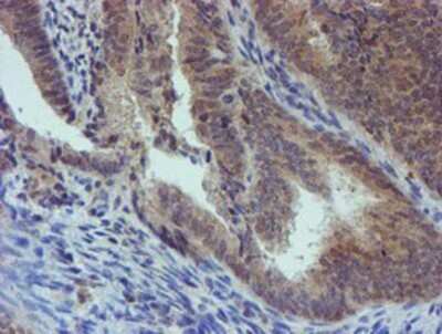 Immunohistochemistry: PGM3 Antibody (OTI1A11) - Azide and BSA Free [NBP2-73362]