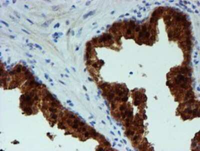 Immunohistochemistry: PGM3 Antibody (OTI1A11) - Azide and BSA Free [NBP2-73362]
