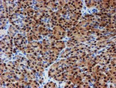 Immunohistochemistry: PGM3 Antibody (OTI1A11) - Azide and BSA Free [NBP2-73362]