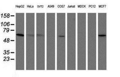 Western Blot: PGM3 Antibody (OTI1A11)Azide and BSA Free [NBP2-73362]