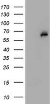 Western Blot: PGM3 Antibody (OTI1A11)Azide and BSA Free [NBP2-73362]