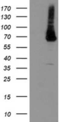 Western Blot: PGM3 Antibody (OTI5C6)Azide and BSA Free [NBP2-73364]