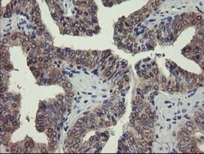 Immunohistochemistry: PGM3 Antibody (OTI5C6) [NBP2-46380]